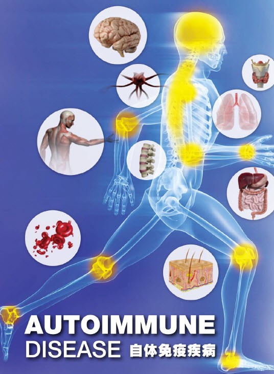 autoimmune-disease