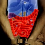 Testimony - Hypertension, Constipation & Varicose Veins - Lucrecia Javier digest-this-facts-1