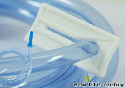 Enema Bucket Tube Stopper