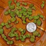 Testimony - IBS & 80 Gallstones Removed - Albert Lee gall-bladder-stone-flush-after-drp-1