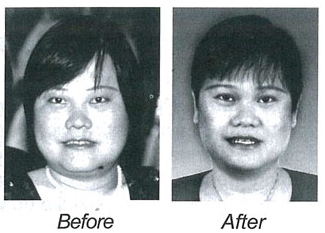 testimony-diabetes-gone-1