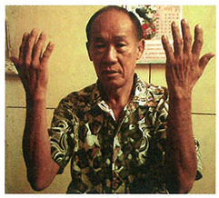 testimony-skin-problem-gone-1